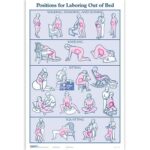 Childbirth Graphics-carte Postures lors de l'accouchement